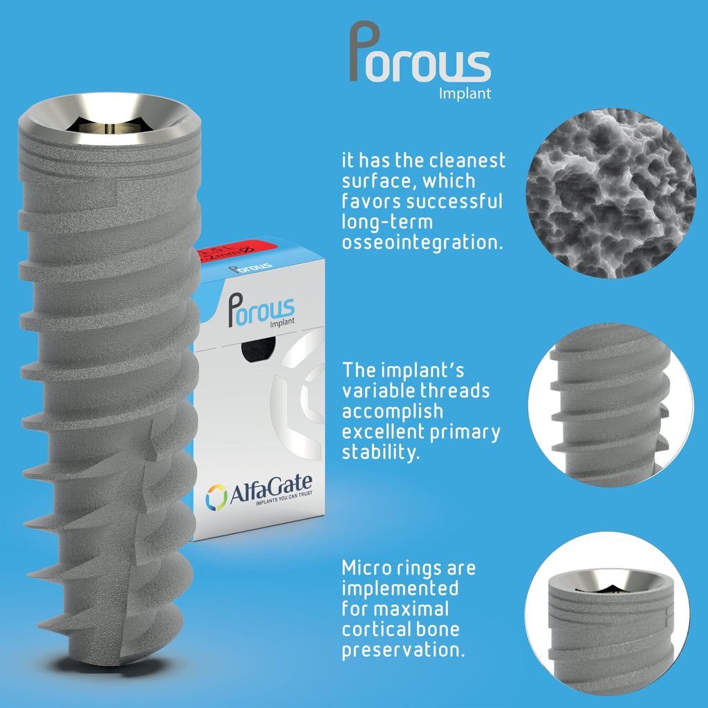 porous dental implant , Porous implant with domed apex for safety near anatomical structures, featuring a clean SLA surface for optimal osseointegration. Includes variable threads, micro-rings, and titanium alloy build. Compatible with a 2.42mm internal hex screw connection.