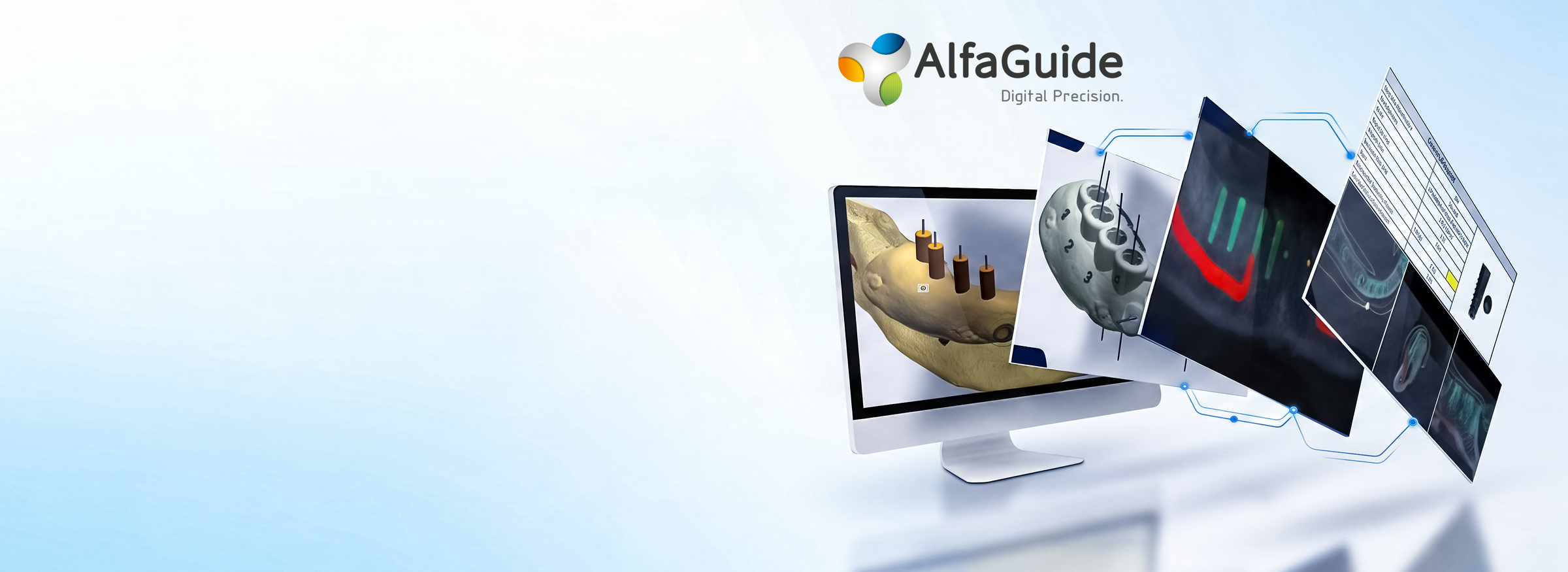 AlfaGuide digital guided surgery planning