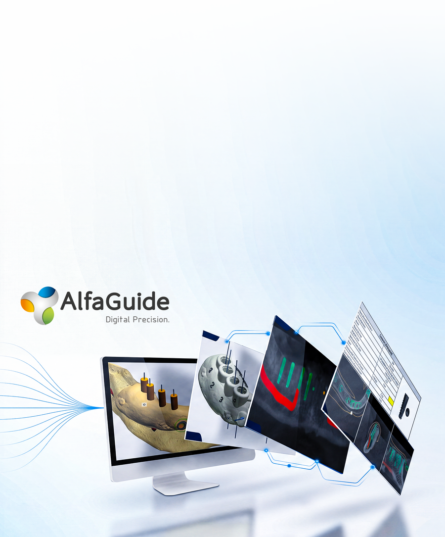 Mobile AlfaGuide hero showing digital guided surgery planning and dental workflow tools