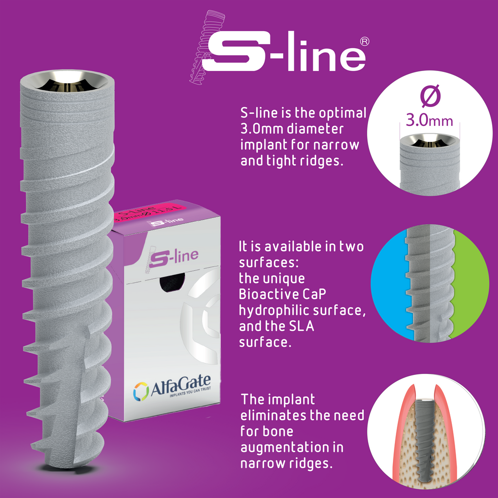 s-line dental implant , S-line dental implant with titanium alloy, SLA surface, and internal hex connection, emphasizing minimally invasive surgery and rehabilitation flexibility.